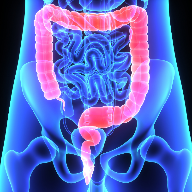 Identifying Different Types of Colorectal Polyps